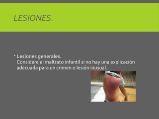 LESIONES.
 Lesiones generales.
Considere el maltrato infantil si no hay una explicación
adecuada para un crimen o lesión inusual.
 