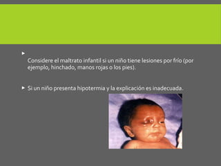  Lesiones por frío
Considere el maltrato infantil si un niño tiene lesiones por frío (por
ejemplo, hinchado, manos rojas o los pies).
 Si un niño presenta hipotermia y la explicación es inadecuada.
 