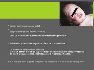  Lesión por inmersión no mortal

Sospeche el maltrato infantil si un niño
tiene un incidente de sumersión no mortales (ahogamiento).
 Sumersión no mortales sugiere una falta de la supervisión.
La asistencia a los servicios médicos.
Si hay un patrón inusual de su presentación en el contacto con los proveedores
de salud, o hay presentaciones frecuentes o reportes de heridas.
 Y la explicación es ausente o inadecuada o si el niño presentación es incompatible.
 