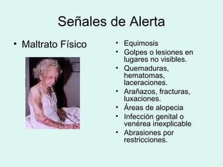 Señales de Alerta
• Maltrato Físico • Equimosis
• Golpes o lesiones en
lugares no visibles.
• Quemaduras,
hematomas,
laceraciones.
• Arañazos, fracturas,
luxaciones.
• Áreas de alopecia
• Infección genital o
venérea inexplicable
• Abrasiones por
restricciones.
 