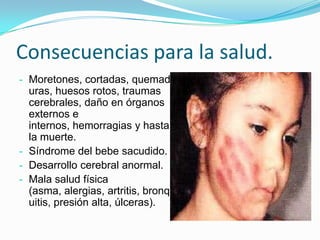 Consecuencias para la salud.
- Moretones, cortadas, quemad
  uras, huesos rotos, traumas
  cerebrales, daño en órganos
  externos e
  internos, hemorragias y hasta
  la muerte.
- Síndrome del bebe sacudido.
- Desarrollo cerebral anormal.
- Mala salud física
  (asma, alergias, artritis, bronq
  uitis, presión alta, úlceras).
 