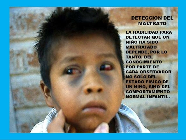 Resultado de imagen para imagenes niños maltratados