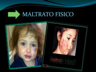 MALTRATO FISICO
 