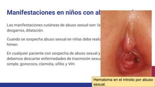 Manifestaciones en niños con abuso sexual
Las manifestaciones cutáneas de abuso sexual son: laceraciones perianales,
desgarros, dilatación.
Cuando se sospecha abuso sexual en niñas debe realizarse examen directo del
himen.
En cualquier paciente con sospecha de abuso sexual y exudado vaginal purulento
debemos descartar enfermedades de trasmisión sexual, como tricomonas, herpes
simple, gonococo, clamidia, sífilis y VIH.
Hematoma en el introito por abuso
sexual.
 