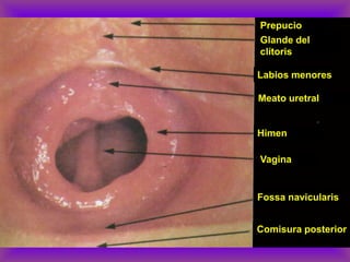 Prepucio
Glande del
clítoris
Labios menores
Meato uretral
Himen
Vagina
Fossa navicularis
Comisura posterior
 