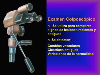 Examen Colposcópico
❖ Se utiliza para comparar
signos de lesiones recientes y
antiguas
❖ Se detectan:
Cambios vasculares
Cicatrices antiguas
Variaciones de la normalidad
 