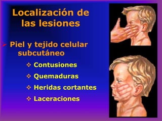 Localización de
las lesiones
➢ Piel y tejido celular
subcutáneo
❖ Contusiones
❖ Quemaduras
❖ Heridas cortantes
❖ Laceraciones
 