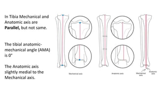 In Tibia Mechanical and
Anatomic axis are
Parallel, but not same.
The tibial anatomic-
mechanical angle (AMA)
is 0°
The Anatomic axis
slightly medial to the
Mechanical axis.
 