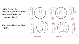 In the femur, the
mechanical and anatomic
axes are different and
converge distally.
The normal femoral AMA
is 7±2°.
 