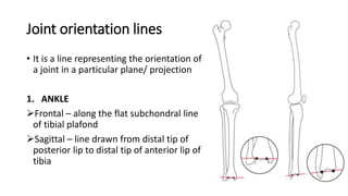 Joint orientation lines
• It is a line representing the orientation of
a joint in a particular plane/ projection
1. ANKLE
Frontal – along the flat subchondral line
of tibial plafond
Sagittal – line drawn from distal tip of
posterior lip to distal tip of anterior lip of
tibia
 