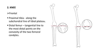 2. KNEE
Frontal
 Proximal tibia - along the
subchondral line of tibial plateau.
 Distal femur – tangential line to
the most distal points on the
convexity of the two femoral
condyles.
 