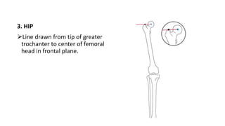3. HIP
Line drawn from tip of greater
trochanter to center of femoral
head in frontal plane.
 