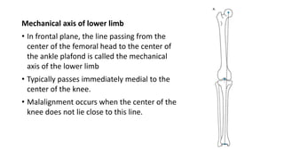 Mechanical axis of lower limb
• In frontal plane, the line passing from the
center of the femoral head to the center of
the ankle plafond is called the mechanical
axis of the lower limb
• Typically passes immediately medial to the
center of the knee.
• Malalignment occurs when the center of the
knee does not lie close to this line.
 