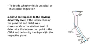• To decide whether this is uniapical or
multiapical angulation
a. CORA corresponds to the obvious
deformity level: If the intersection of
the proximal and distal axes
corresponds to the obvious level of
deformity, the intersection point is the
CORA and deformity is uniapical (in the
respective plane)
 
