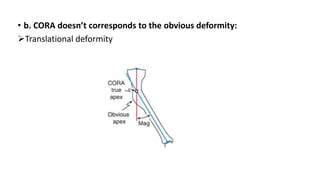 • b. CORA doesn’t corresponds to the obvious deformity:
Translational deformity
 
