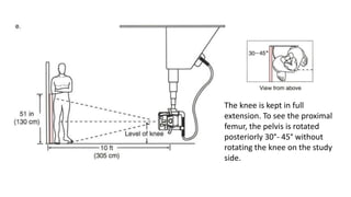 The knee is kept in full
extension. To see the proximal
femur, the pelvis is rotated
posteriorly 30°- 45° without
rotating the knee on the study
side.
 