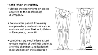• Limb length Discrepancy
Elevate the shorter limb on blocks
adjusted to the approximate
discrepancy.
Prevents the patient from using
compensatory mechanisms such as
contralateral knee flexion, ipsilateral
ankle equinus, pelvic tilt.
compensatory mechanisms cause
uneven loading of the limbs and may
alter the alignment and leg length
measurement on the radiograph
 