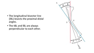 • The longitudinal bisector line
(lBL) bisects the proximal-distal
angles.
• The tBL and lBL are always
perpendicular to each other.
 