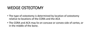 WEDGE OSTEOTOMY
• The type of osteotomy is determined by location of osteotomy
relative to locations of the CORA and the ACA
• The CORA and ACA may lie on concave or convex side of cortex, or
in the middle of the bone.
 