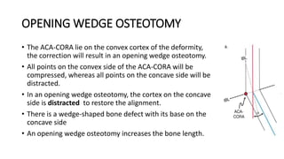 OPENING WEDGE OSTEOTOMY
• The ACA-CORA lie on the convex cortex of the deformity,
the correction will result in an opening wedge osteotomy.
• All points on the convex side of the ACA-CORA will be
compressed, whereas all points on the concave side will be
distracted.
• In an opening wedge osteotomy, the cortex on the concave
side is distracted to restore the alignment.
• There is a wedge-shaped bone defect with its base on the
concave side
• An opening wedge osteotomy increases the bone length.
 