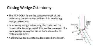 Closing Wedge Osteotomy
• The ACA-CORA lie on the concave cortex of the
deformity, the correction will result in an closing
wedge osteotomy.
• In a closing wedge osteotomy, the cortex on the
convex side is compressed, this involves removal of a
bone wedge across the entire bone diameter to
restore alignment.
• A closing wedge osteotomy decreases bone length.
 