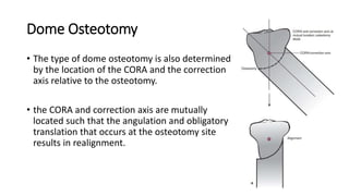 Dome Osteotomy
• The type of dome osteotomy is also determined
by the location of the CORA and the correction
axis relative to the osteotomy.
• the CORA and correction axis are mutually
located such that the angulation and obligatory
translation that occurs at the osteotomy site
results in realignment.
 