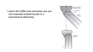• when the CORA and correction axis are
not mutually located results in a
translational deformity.
 