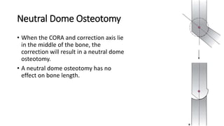 Neutral Dome Osteotomy
• When the CORA and correction axis lie
in the middle of the bone, the
correction will result in a neutral dome
osteotomy.
• A neutral dome osteotomy has no
effect on bone length.
 