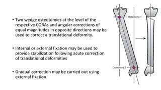 • Two wedge osteotomies at the level of the
respective CORAs and angular corrections of
equal magnitudes in opposite directions may be
used to correct a translational deformity.
• Internal or external fixation may be used to
provide stabilization following acute correction
of translational deformities
• Gradual correction may be carried out using
external fixation
 