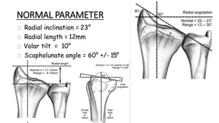 Malunited distal radius fracture | PPTX
