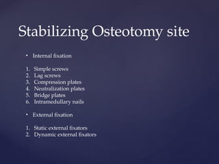 Stabilizing Osteotomy site
• Internal fixation
1. Simple screws
2. Lag screws
3. Compression plates
4. Neutralization plates
5. Bridge plates
6. Intramedullary nails
• External fixation
1. Static external fixators
2. Dynamic external fixators
 
