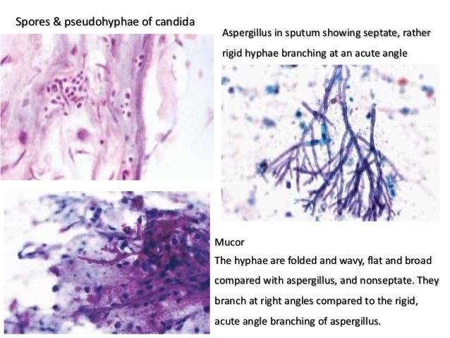 Cytologic assessment of bronchopulmonary lesions