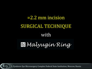 Surgical strategies for small pupils - Malyugin Ring | PPTX