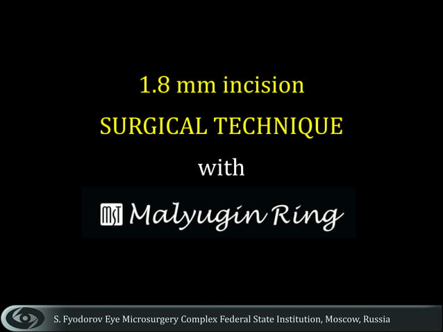 Surgical strategies for small pupils - Malyugin Ring | PPTX