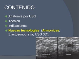 CONTENIDO
 Anatomía por USG
 Técnica
 Indicaciones
 Nuevas tecnologías (Armonicas,
Elastosonografía, USG 3D).
 
