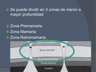  Se puede dividir en 3 zonas de menor a
mayor profundidad
 Zona Premamaria
 Zona Mamaria
 Zona Retromamaria
 