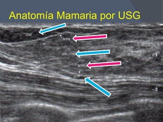 Anatomía Mamaria por USG
 