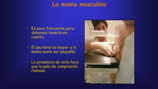 La mama masculina
• Es poco frecuente pero
debemos tenerla en
cuenta.
• El pectoral es mayor y la
mama suele ser pequeña.
• La presencia de vello hace
que la pala de compresión
resbale.
 
