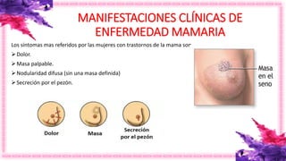 MANIFESTACIONES CLÍNICAS DE
ENFERMEDAD MAMARIA
Los síntomas mas referidos por las mujeres con trastornos de la mama son
Dolor.
Masa palpable.
Nodularidad difusa (sin una masa definida)
Secreción por el pezón.
 