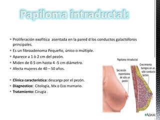  Proliferación exofitica asentada en la pared d los conductos galactóforos
principales.
 Es un fibroadenoma Pequeño, único o múltiple.
 Aparece a 1 ò 2 cm del pezón.
 Miden de 0.5 cm hasta 4 -5 cm diámetro.
 Afecta mujeres de 40 – 50 años.
 Clínica característica: descarga por el pezón.
 Diagnostico: Citología, Mx o Eco mamario.
 Tratamiento: Cirugía .

 