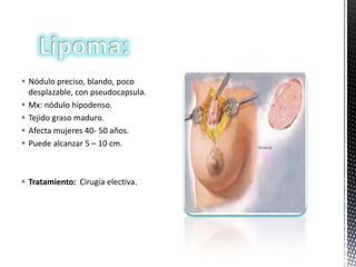  Nódulo preciso, blando, poco
desplazable, con pseudocapsula.
 Mx: nódulo hipodenso.
 Tejido graso maduro.
 Afecta mujeres 40- 50 años.
 Puede alcanzar 5 – 10 cm.

 Tratamiento: Cirugía electiva.

 