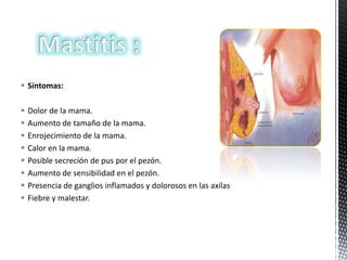  Síntomas:









Dolor de la mama.
Aumento de tamaño de la mama.
Enrojecimiento de la mama.
Calor en la mama.
Posible secreción de pus por el pezón.
Aumento de sensibilidad en el pezón.
Presencia de ganglios inflamados y dolorosos en las axilas
Fiebre y malestar.

 