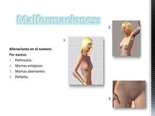 2.
1.
Alteraciones en el numero.
Por exceso:
1. Polimastia.
2. Mamas ectópicas.
3. Mamas aberrantes.
4. Politelia.

3.

 