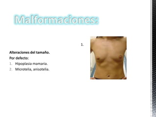 1.
Alteraciones del tamaño.
Por defecto:
1. Hipoplasia mamaria.
2. Microtelia, anisotelia.

 