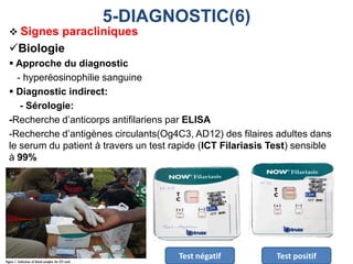  Signes paracliniques
Biologie
 Approche du diagnostic
- hyperéosinophilie sanguine
 Diagnostic indirect:
- Sérologie:
-Recherche d’anticorps antifilariens par ELISA
-Recherche d’antigènes circulants(Og4C3, AD12) des filaires adultes dans
le serum du patient à travers un test rapide (ICT Filariasis Test) sensible
à 99%
5-DIAGNOSTIC(6)
Test négatif Test positif
 