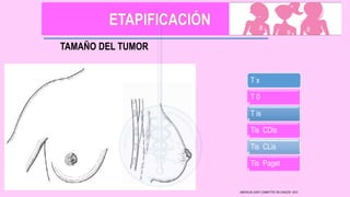 TAMAÑO DEL TUMOR
T x
T 0
T is
Tis CDis
Tis CLis
Tis Paget
AMERICAN JOINT COMMITTEE ON CANCER • 2010
 