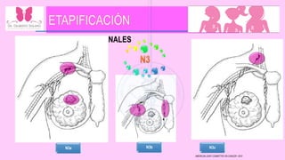 GANGLIOS REGIONALES
AMERICAN JOINT COMMITTEE ON CANCER • 2010
N3c
N3b
N3a
 