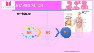 METÁSTASIS
AMERICAN JOINT COMMITTEE ON CANCER • 2010
 