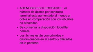 • ADENOSIS ESCLEROSANTE: el
número de ácinos por conducto
terminal esta aumentado al menos al
doble en comparación con los lobulillos
no afectados.
• Se conserva la disposición lobulillar
normal.
• Los ácinos están comprimidos y
distorsionados en el centro y dilatados
en la periferia.
 