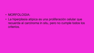 • MORFOLOGIA:
• La hiperplasia atípica es una proliferación celular que
recuerda al carcinoma in situ, pero no cumple todos los
criterios.
 